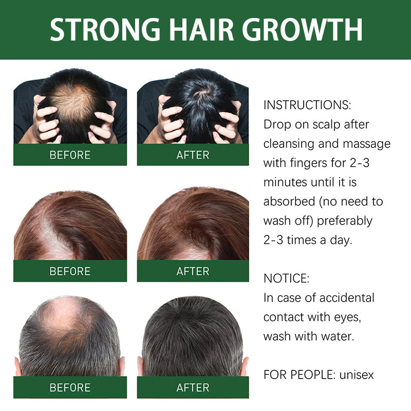 Herbal Fusion Rapid Hair Growth Formula